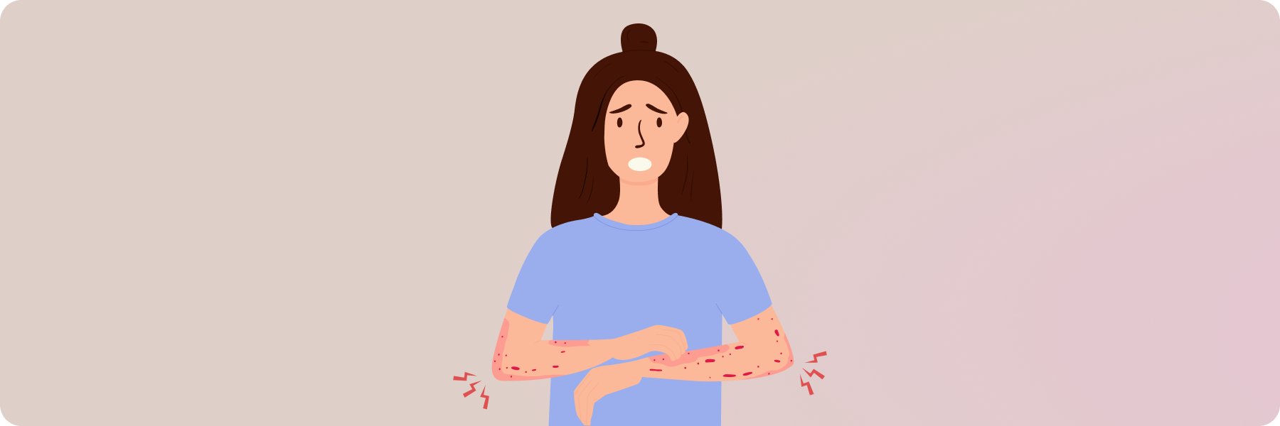 Почему Я? Как и у кого развивается крапивница Почему Я? Как и у кого развивается крапивница